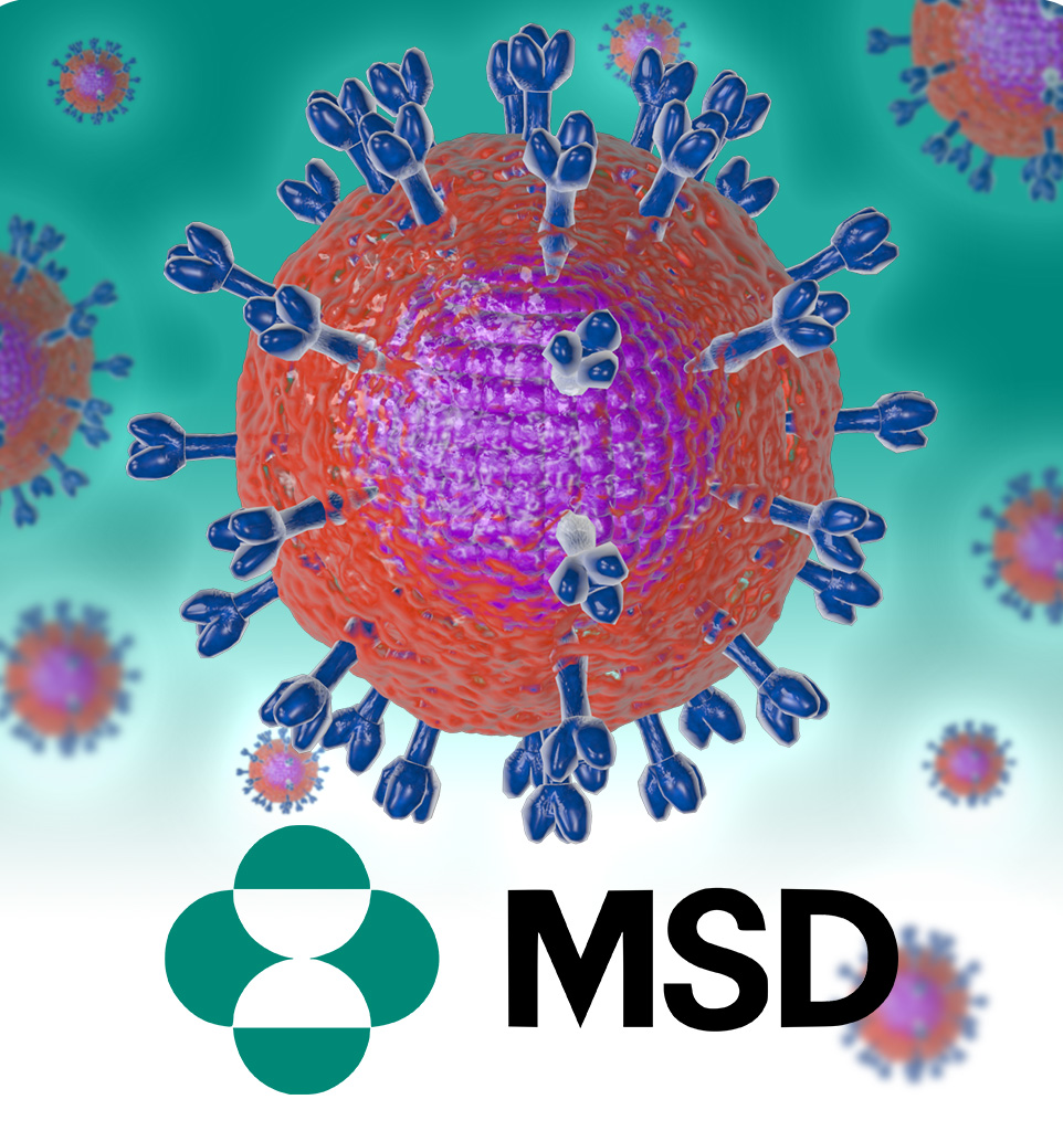 MSD HIV